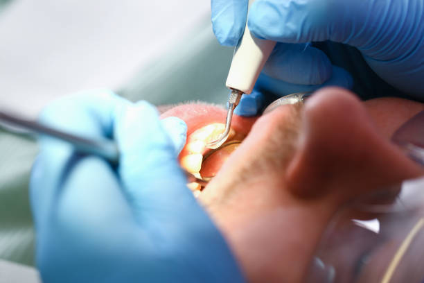 Best Broken or Cracked Tooth Emergency Dentist in Westbrook, ME