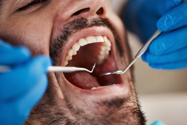Best Emergency Dentist for Lost Fillings or Crowns in Westbrook, ME