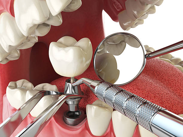 Best Emergency Root Canal Treatment in Westbrook, ME