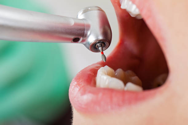 Best Emergency Dentist for Knocked-Out Tooth in Westbrook, ME